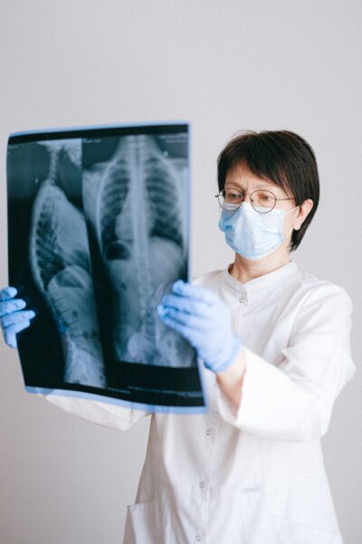 A respiratory therapist holding up x-ray results.